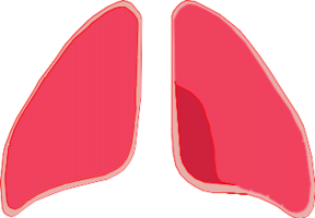 Drawing of a diseased pair of lungs