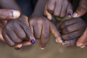 End Polio Now!