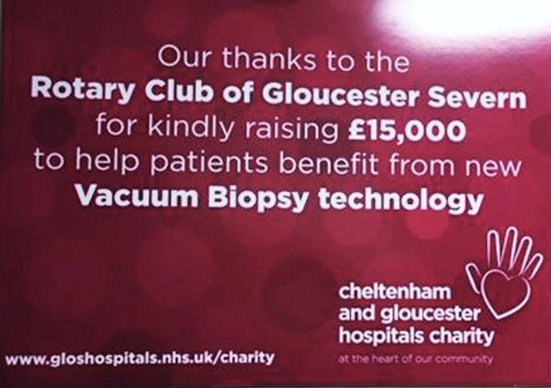 Visit to the Vacuum Biopsy Machine a Cheltenham Oncology Unit - 