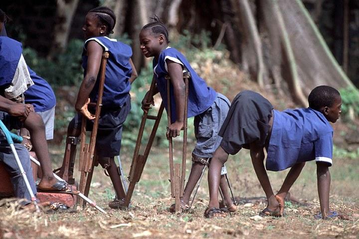Polio Eradication - 